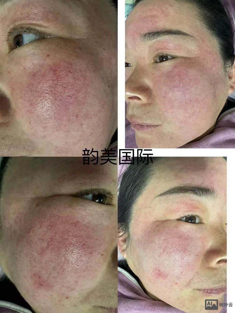 如何利用ps弄成有脸部血丝