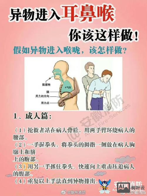 腔内的异物强制命令