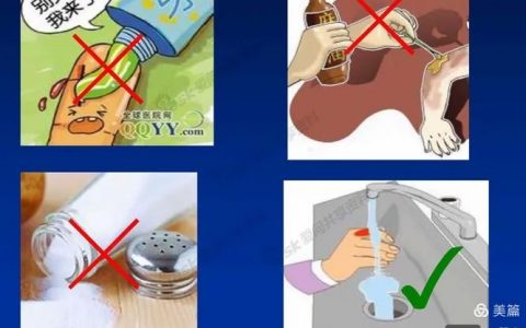 腔内异物为何被强制命令？