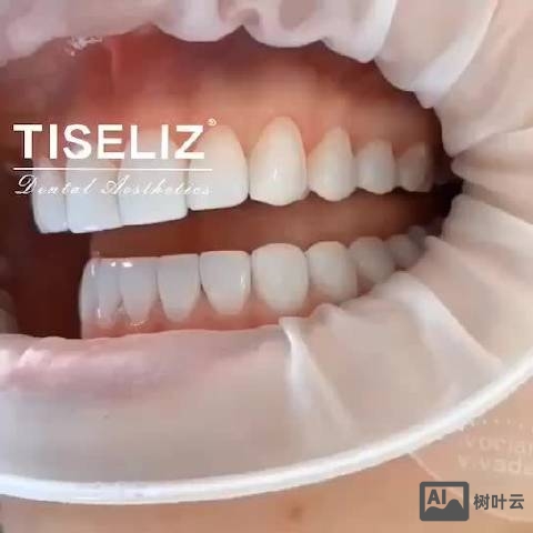 tiseliz招聘